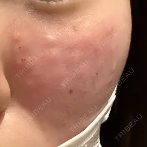 アイビークリニック 千葉美容外科アイビークリニック口コミ