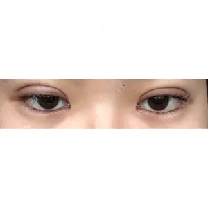 アリエル美容クリニック アリエル美容クリニック 水戸院口コミ