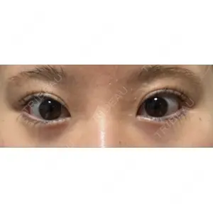 ヴェリテクリニック ヴェリテクリニック 銀座院口コミ