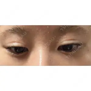 ヴェリテクリニック ヴェリテクリニック 銀座院口コミ