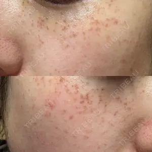 ルラ美容クリニック ルラ美容クリニック 札幌本院口コミ