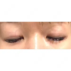 TCB東京中央美容外科 TCB東京中央美容外科 仙台駅前院口コミ