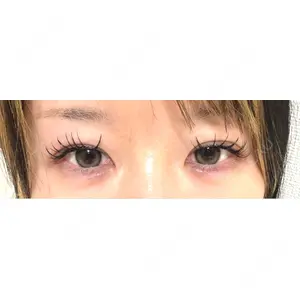 TCB東京中央美容外科 TCB東京中央美容外科 仙台駅前院口コミ