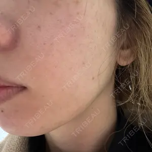 おおたかの森ビューティークリニック おおたかの森ビューティークリニック口コミ