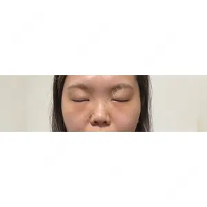 湘南美容クリニック 湘南美容クリニック 千葉センシティ院口コミ