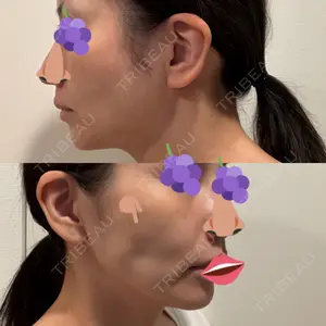 PRISM Beauty Clinic  PRISM Beauty Clinic 新宿院口コミ