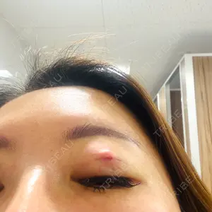TCB東京中央美容外科 TCB東京中央美容外科 水戸院口コミ