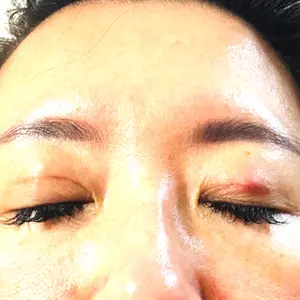 TCB東京中央美容外科 TCB東京中央美容外科 水戸院口コミ