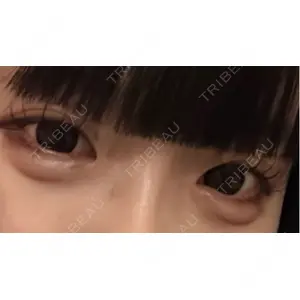 プロクリニック PRO CLINIC プロクリニック 銀座院口コミ