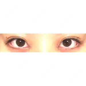 Nebula Clinic 新宿美容外科ネビュラクリニック口コミ