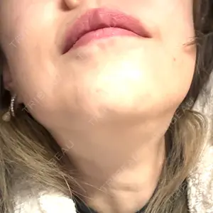口コミ
