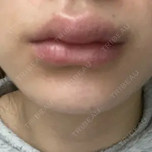 ルラ美容クリニック 福岡天神院の