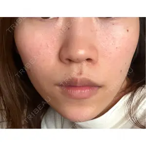 ビラビューティークリニック 博多美容外科/美容皮膚科 ビラビューティークリニック口コミ