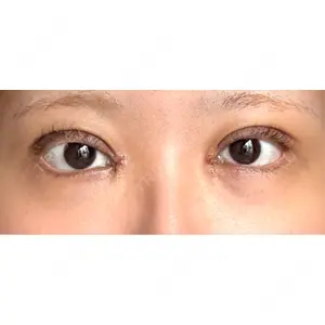 東京シンデレラ美容外科 東京シンデレラ美容外科 池袋院口コミ