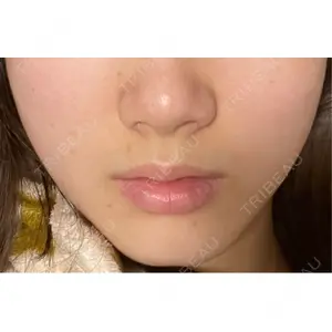 TCB東京中央美容外科 TCB東京中央美容外科 柏院口コミ