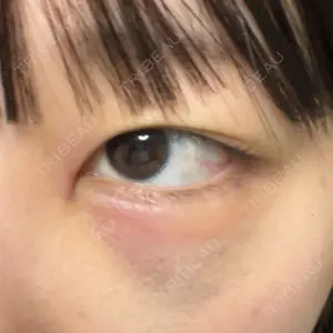 TCB東京中央美容外科 TCB東京中央美容外科 名古屋栄院口コミ