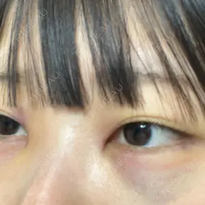 TCB東京中央美容外科 TCB東京中央美容外科 名古屋栄院口コミ