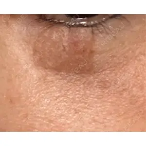 ルラ美容クリニック ルラ美容クリニック 横浜院口コミ