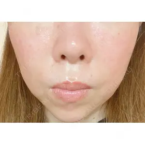 白金ビークリニック 本院口コミ