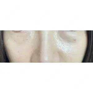 アイビークリニック 千葉美容外科アイビークリニック口コミ