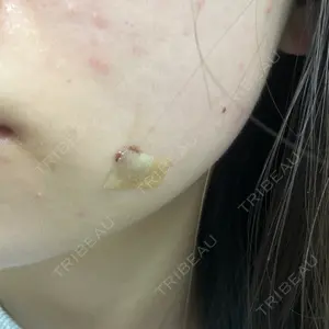 Leap beauty clinic口コミ