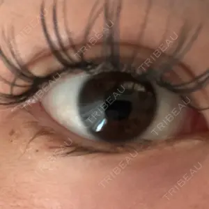 ルラ美容クリニック ルラ美容クリニック 横浜院口コミ