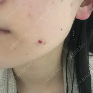 Leap beauty clinic口コミ