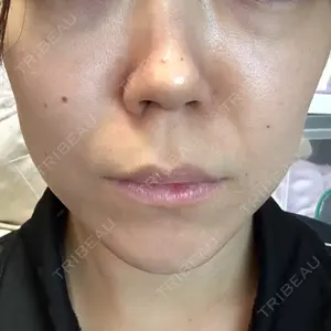 池袋美容クリニック 池袋美容クリニック口コミ