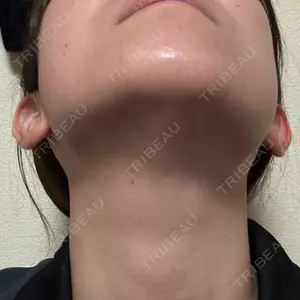 池袋美容クリニック 池袋美容クリニック口コミ