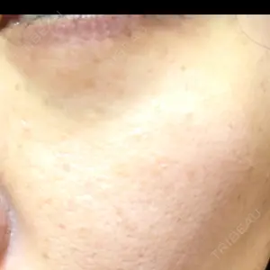 BITO BEAUTY CLINIC BITO BEAUTY CLINIC口コミ