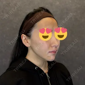 AVAN TOKYO 銀座脂肪吸引 クリニックの