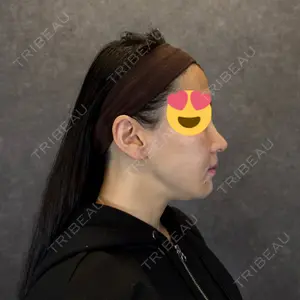 AVAN TOKYO 銀座脂肪吸引 クリニックの