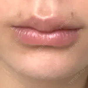 ルラ美容クリニック 福岡天神院の