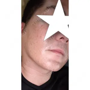 ビラビューティークリニック 博多美容外科/美容皮膚科 ビラビューティークリニック口コミ