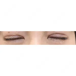 湘南美容クリニック 湘南美容クリニック 上野院口コミ