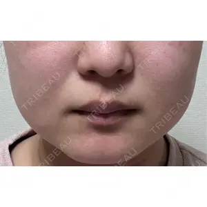 ビラビューティークリニック 博多美容外科/美容皮膚科 ビラビューティークリニック口コミ