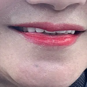 ビラビューティークリニック 博多美容外科/美容皮膚科 ビラビューティークリニック口コミ