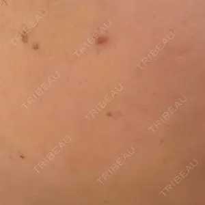 東京美容皮膚科アロエクリニック 東京美容皮膚科アロエクリニック池袋口コミ