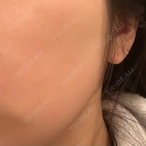 APスキンクリニック銀座口コミ