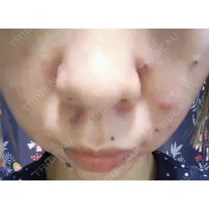 KMクリニック KM新宿クリニック口コミ