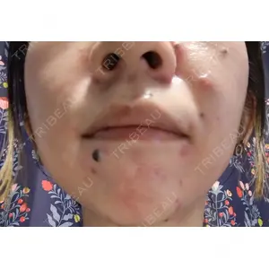 KMクリニック KM新宿クリニック口コミ