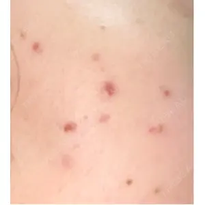 ルラ美容クリニック ルラ美容クリニック 郡山院口コミ