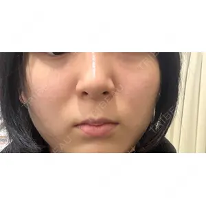 東京美容皮膚科アロエクリニック 東京美容皮膚科アロエクリニック池袋口コミ