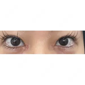 東京シンデレラ美容外科 東京シンデレラ美容外科 池袋院口コミ