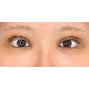 東京シンデレラ美容外科 東京シンデレラ美容外科 池袋院口コミ