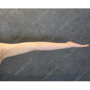 AVAN TOKYO 銀座脂肪吸引 クリニックの