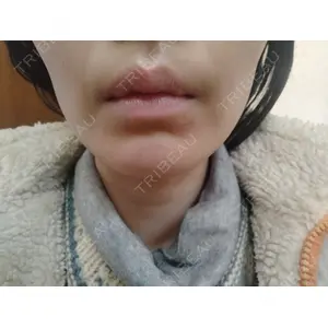 池袋美容クリニック 池袋美容クリニック口コミ