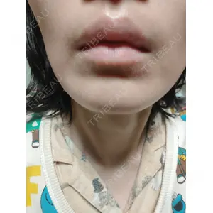 池袋美容クリニック 池袋美容クリニック口コミ