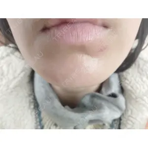 池袋美容クリニック 池袋美容クリニック口コミ