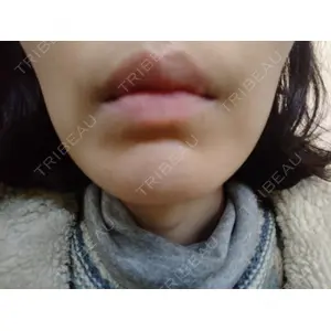 池袋美容クリニック 池袋美容クリニック口コミ